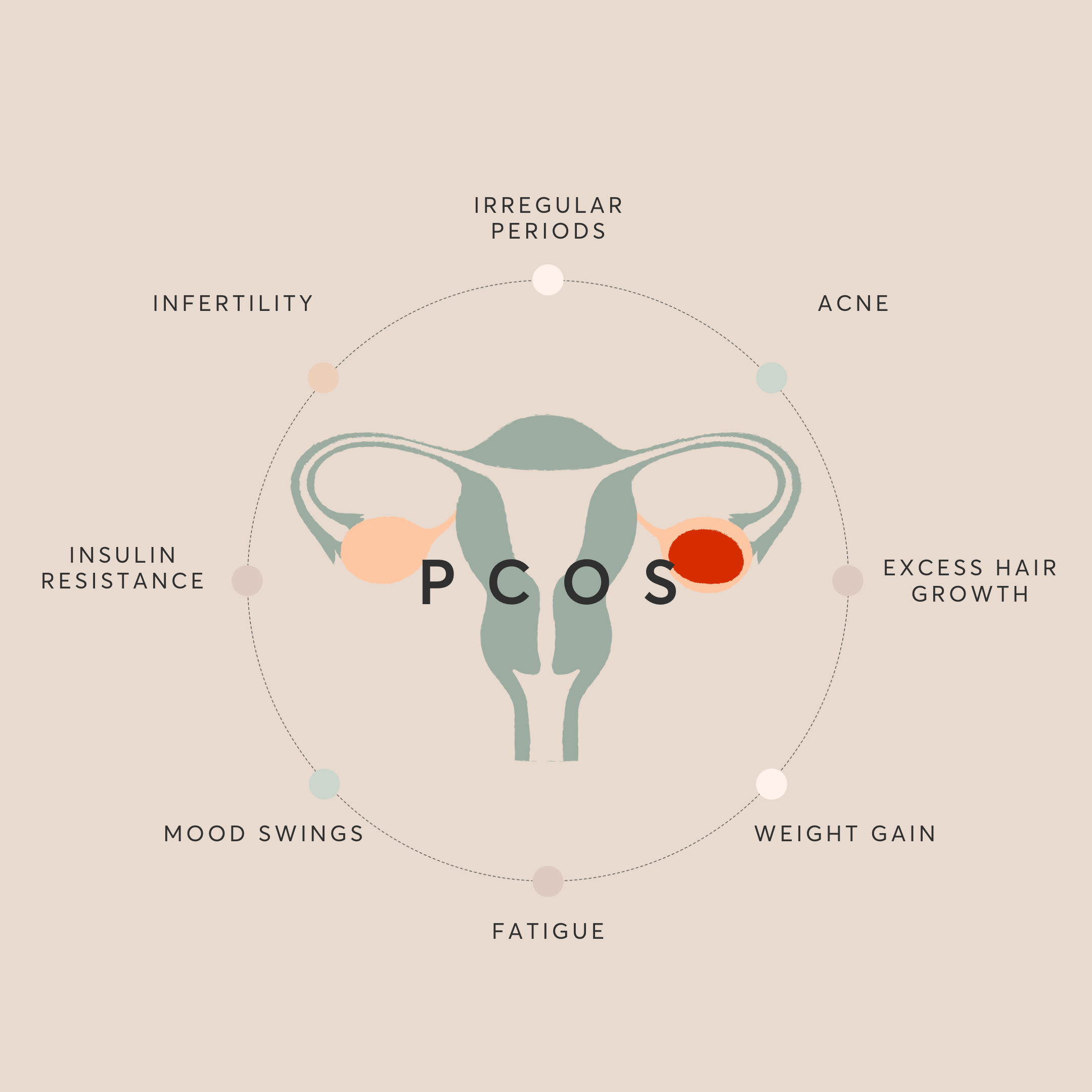 Pcos Update Conceiving with PCOS: Lifestyle and Nutrition Advice – Naître