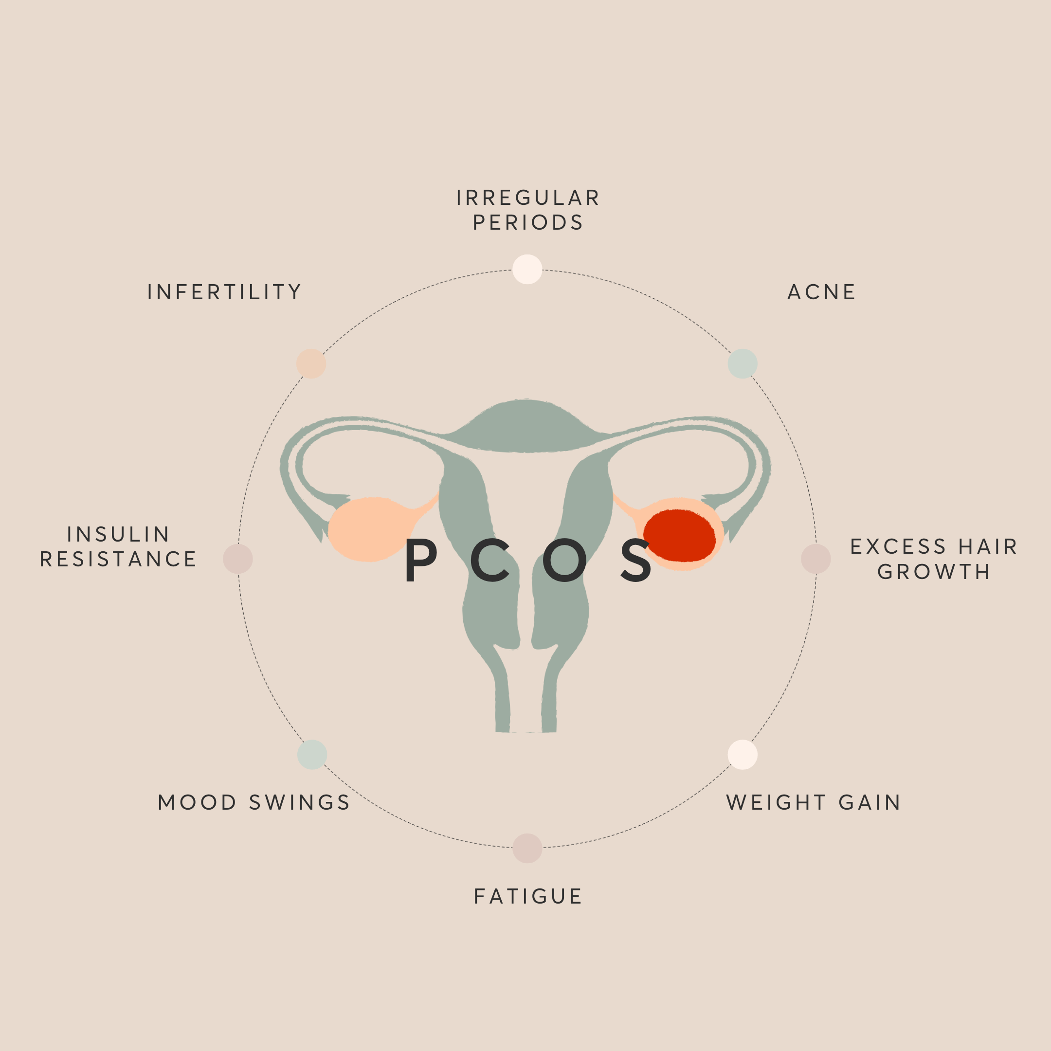 Conceiving with PCOS: Lifestyle and Nutrition Advice